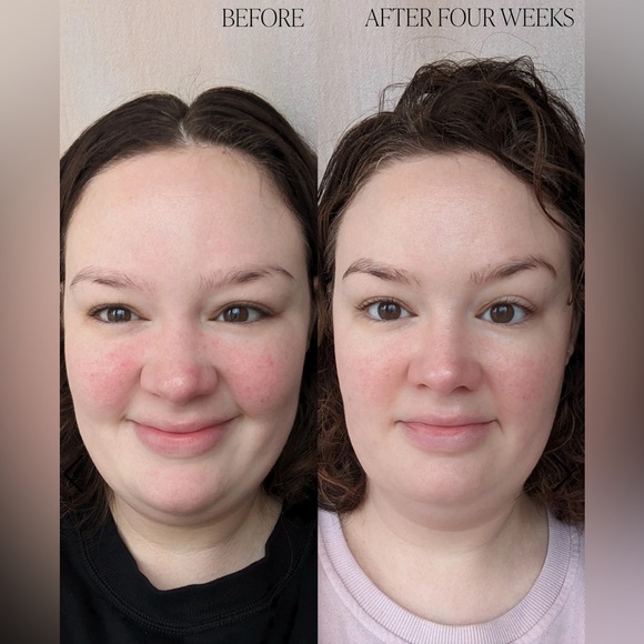 Byroe Basil Dark Spot Correcting Cream - Picture 9 of 11